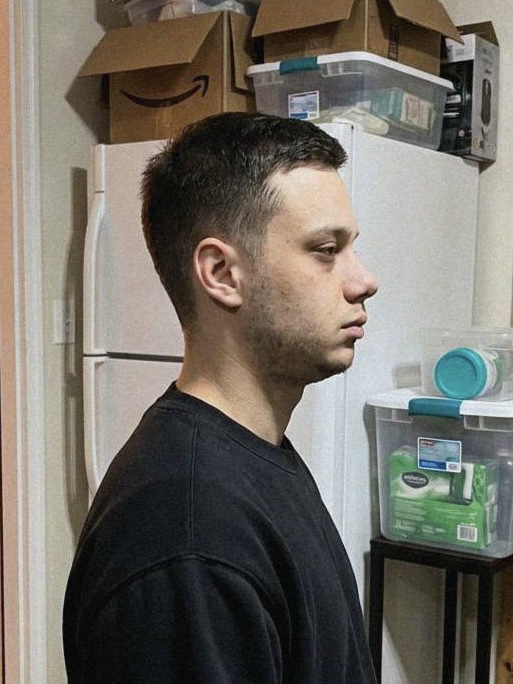 Before